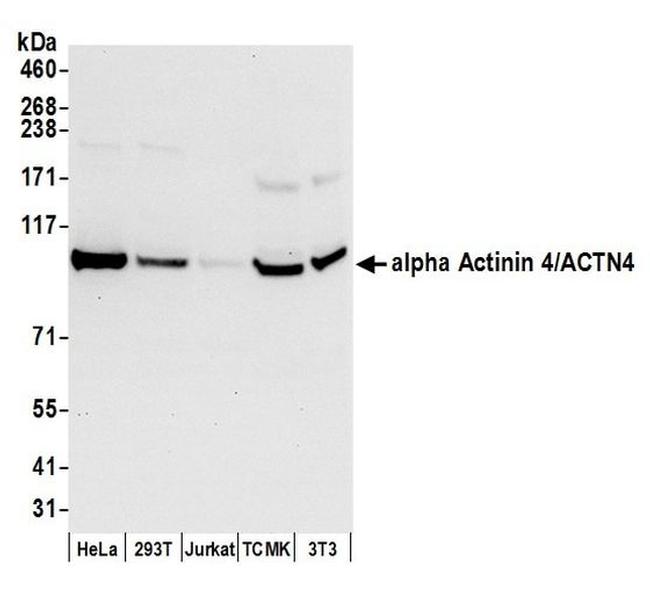 alpha Actinin 4/ACTN4 Antibody in Western Blot (WB)