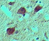 14-3-3 zeta Antibody in Immunohistochemistry (Paraffin) (IHC (P))