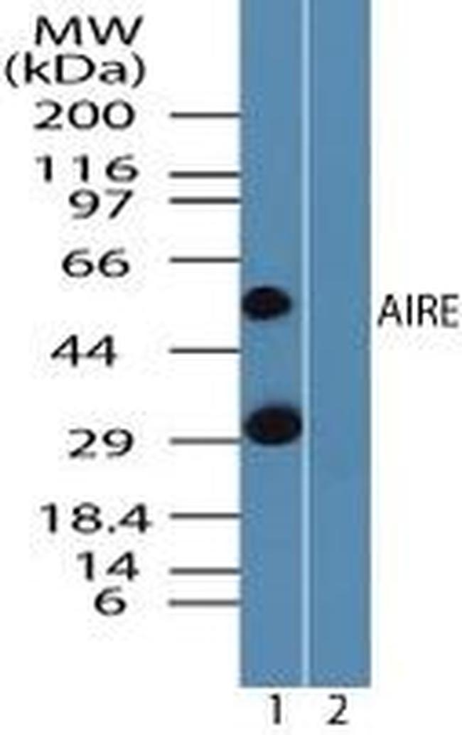 AIRE Antibody in Western Blot (WB)