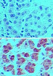 ATG7 Antibody in Immunohistochemistry (Paraffin) (IHC (P))