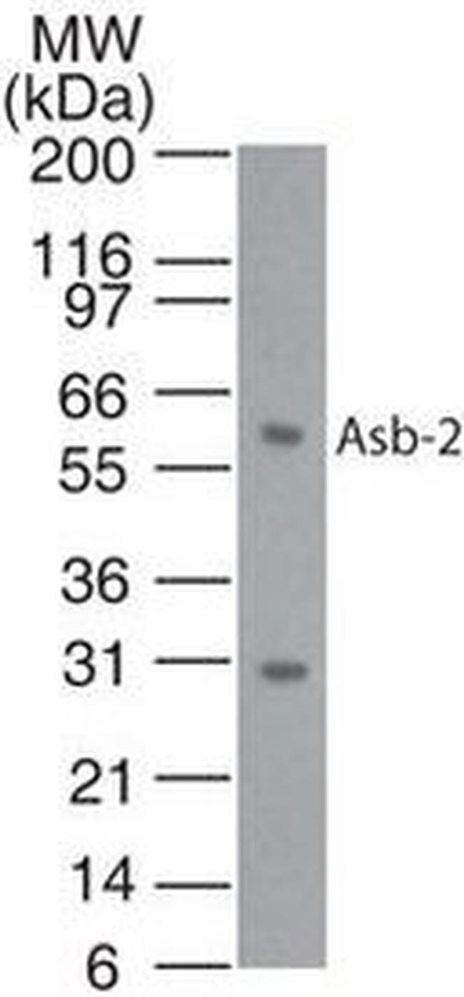 ASB2 Antibody in Western Blot (WB)
