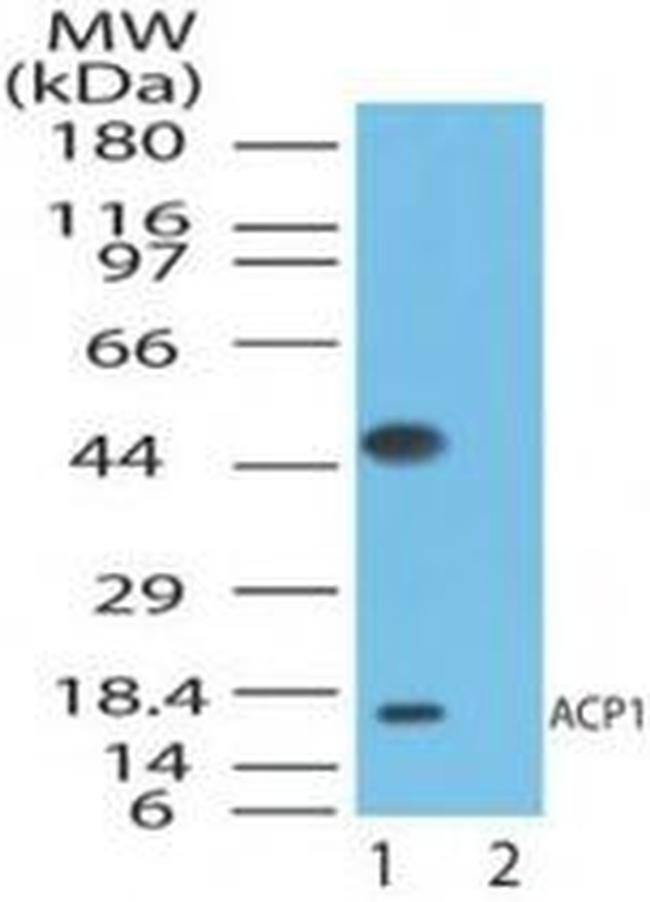 Acid Phosphatase 1 Antibody in Western Blot (WB)