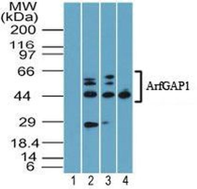 ARFGAP1 Antibody in Western Blot (WB)