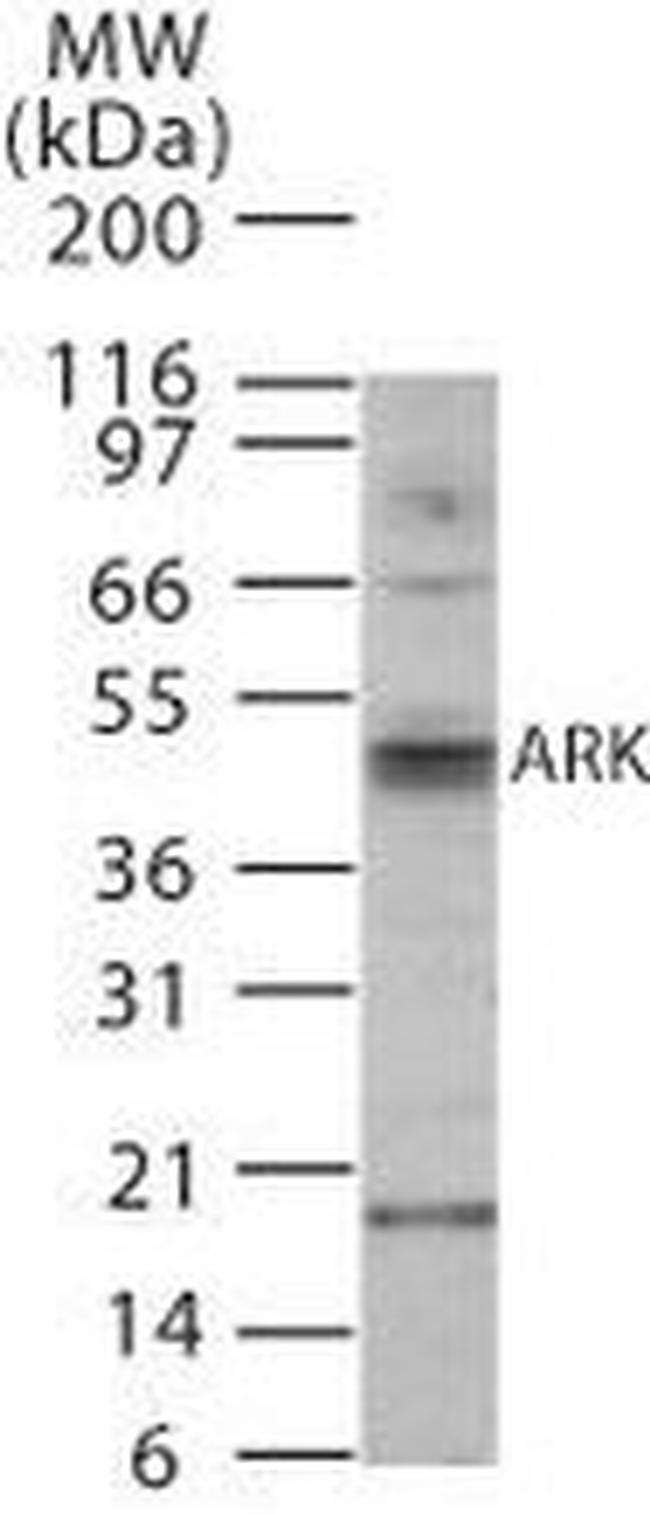Aurora A/B Antibody in Western Blot (WB)