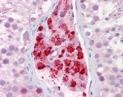 Aurora B Antibody in Immunohistochemistry (IHC)