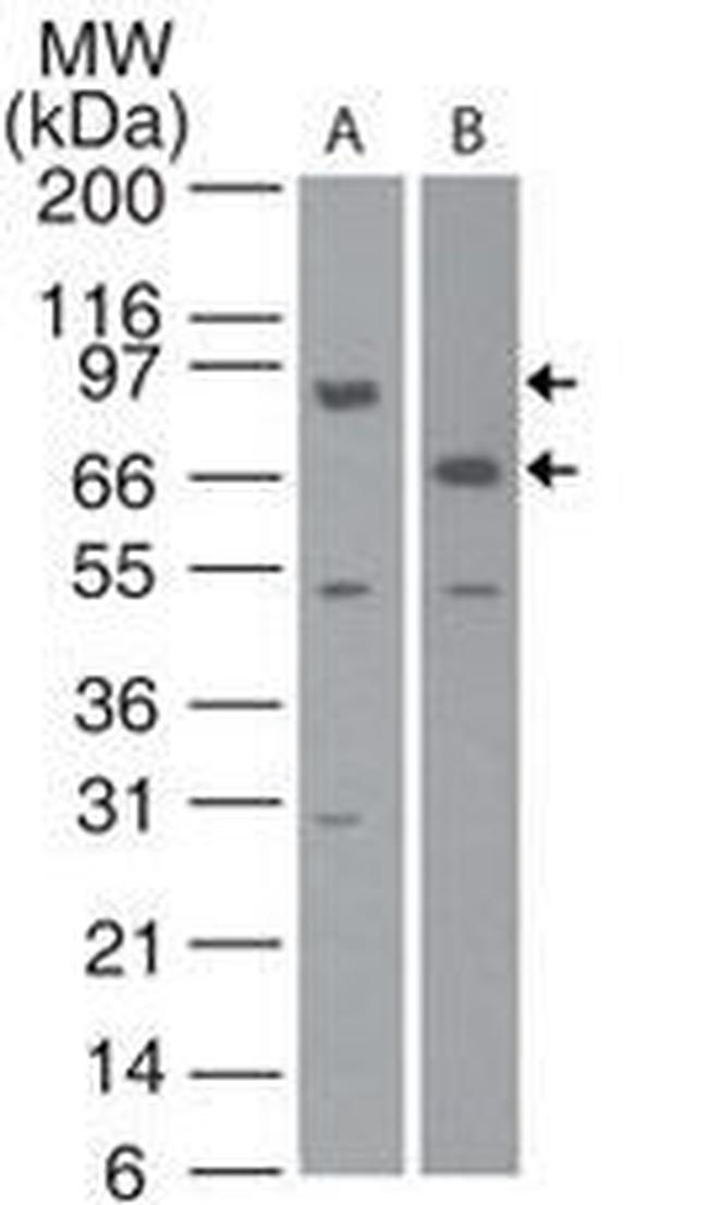cIAP1 Antibody in Western Blot (WB)