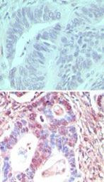 TLR3 Antibody in Immunohistochemistry (Paraffin) (IHC (P))