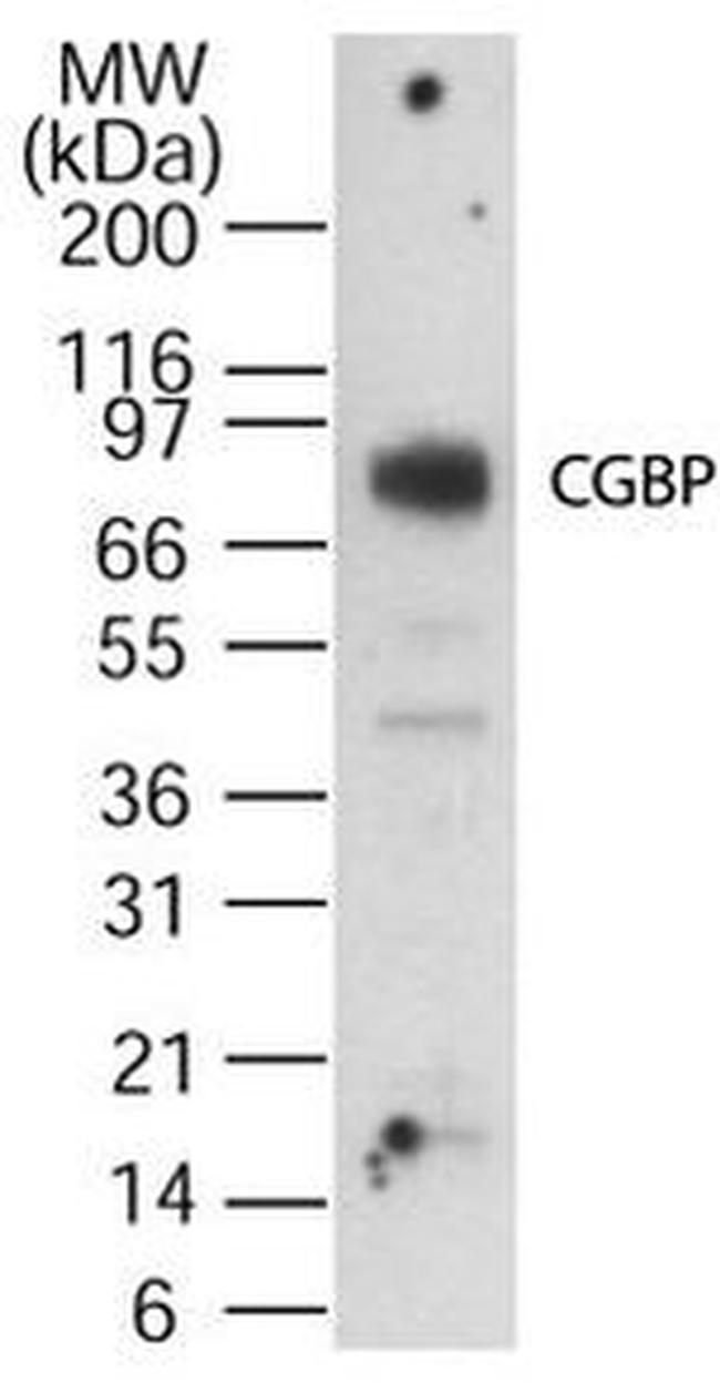 CGBP Antibody in Western Blot (WB)