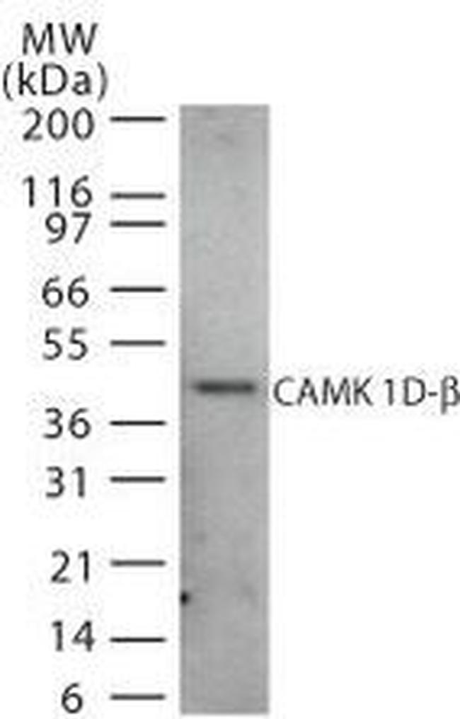 CAMK1D Antibody in Western Blot (WB)