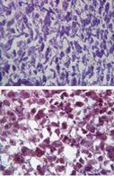 Catalase Antibody in Immunohistochemistry (Paraffin) (IHC (P))