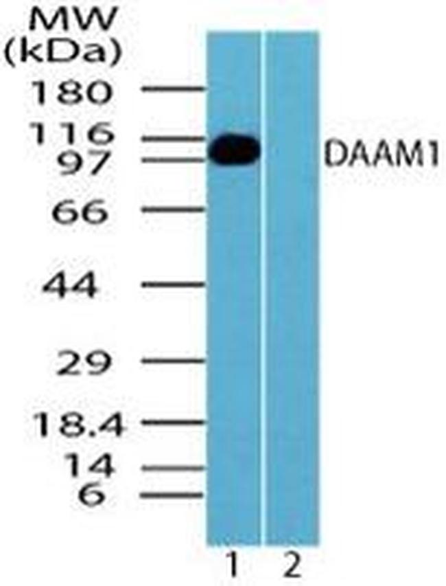 DAAM1 Antibody in Western Blot (WB)