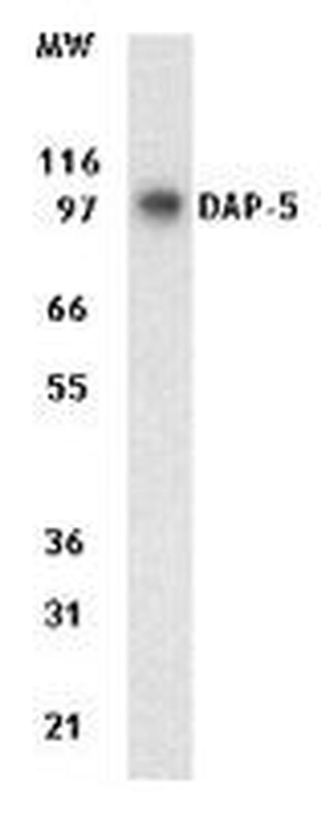 DAP5 Antibody in Western Blot (WB)