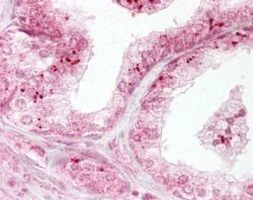 DIABLO Antibody in Immunohistochemistry (IHC)