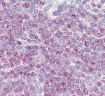 DLL1 Antibody in Immunohistochemistry (Paraffin) (IHC (P))