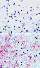 DMAP1 Antibody in Immunohistochemistry (Paraffin) (IHC (P))