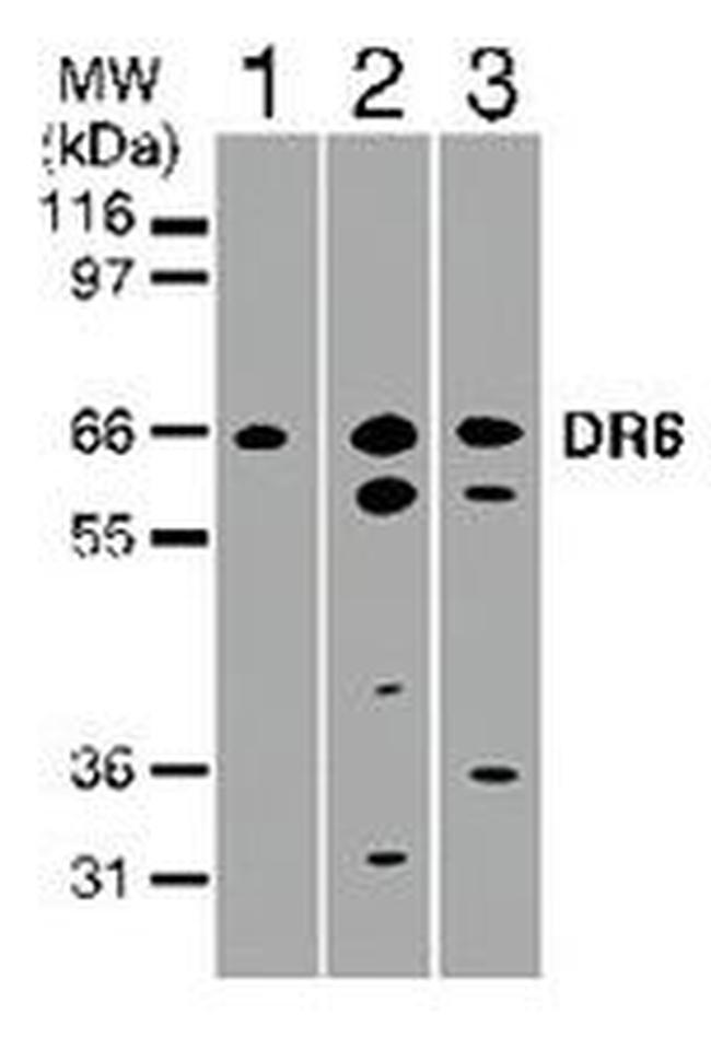 DR6 Antibody in Western Blot (WB)