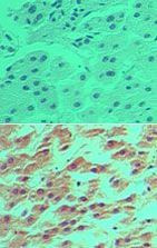 DRAM Antibody in Immunohistochemistry (Paraffin) (IHC (P))