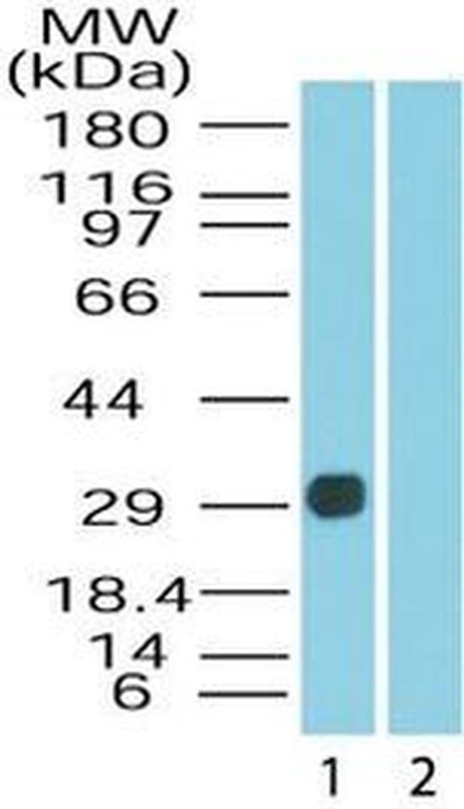 DUSP13 Isoform 3 Antibody in Western Blot (WB)