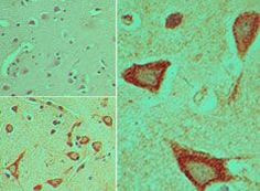 DVL3 Antibody in Immunohistochemistry (Paraffin) (IHC (P))
