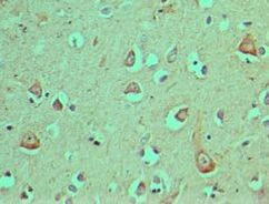 DEC1 Antibody in Immunohistochemistry (Paraffin) (IHC (P))