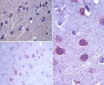 ERAS Antibody in Immunohistochemistry (Paraffin) (IHC (P))