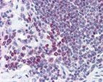 CRM1 Antibody in Immunohistochemistry (IHC)
