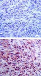 FMN2 Antibody in Immunohistochemistry (Paraffin) (IHC (P))
