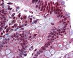 FOXC1 Antibody in Immunohistochemistry (IHC)
