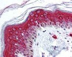 FOXO3A Antibody in Immunohistochemistry (IHC)