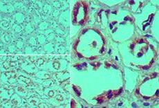 Furin Antibody in Immunohistochemistry (Paraffin) (IHC (P))