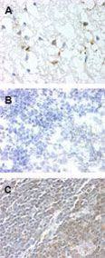 GPR83 Antibody in Immunohistochemistry (Paraffin) (IHC (P))