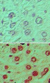 GARP Antibody in Immunohistochemistry (Paraffin) (IHC (P))