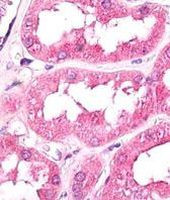 GNPDA1 Antibody in Immunohistochemistry (Paraffin) (IHC (P))