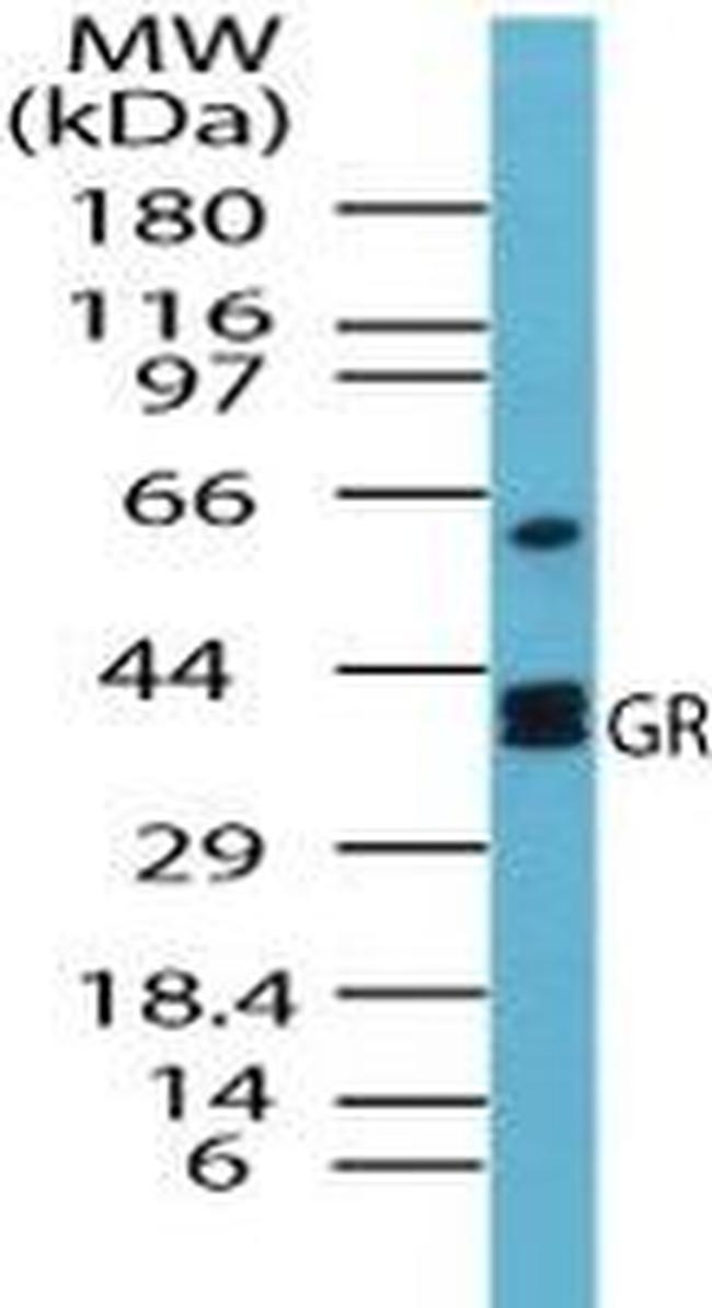 GSR Antibody in Western Blot (WB)