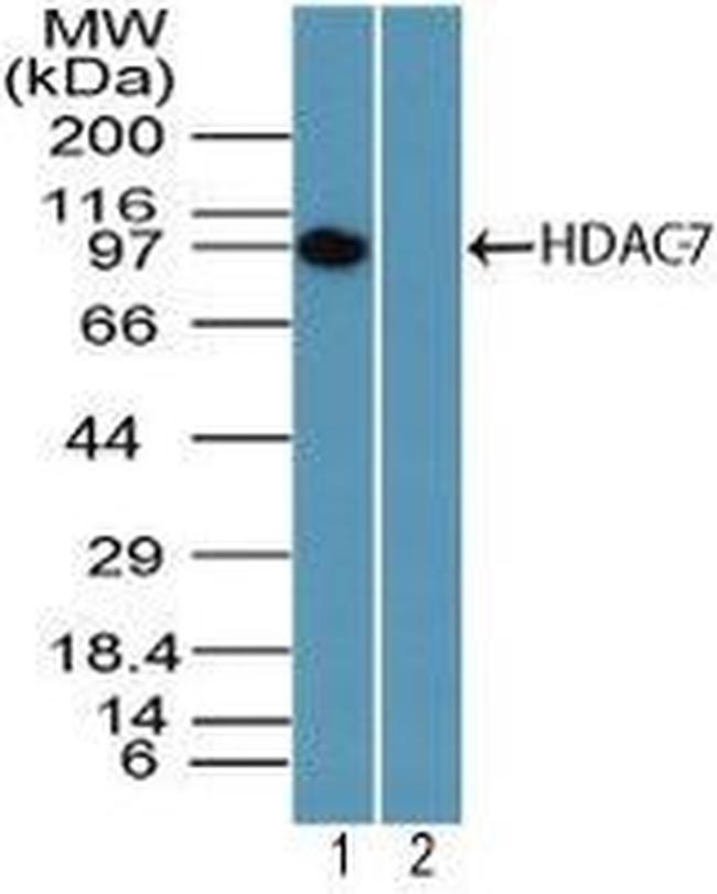 HDAC7 Antibody in Western Blot (WB)