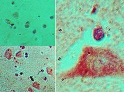HOXB4 Antibody in Immunohistochemistry (Paraffin) (IHC (P))