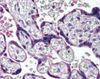 HAPLN3 Antibody in Immunohistochemistry (IHC)