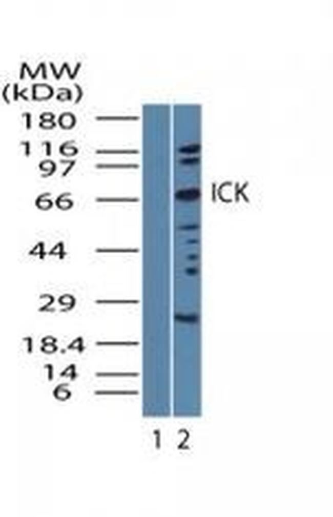ICK Antibody in Western Blot (WB)
