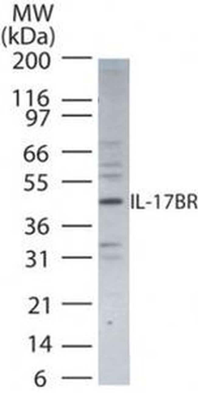 IL17RB Antibody in Western Blot (WB)