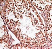 LIN28A Antibody in Immunohistochemistry (Paraffin) (IHC (P))