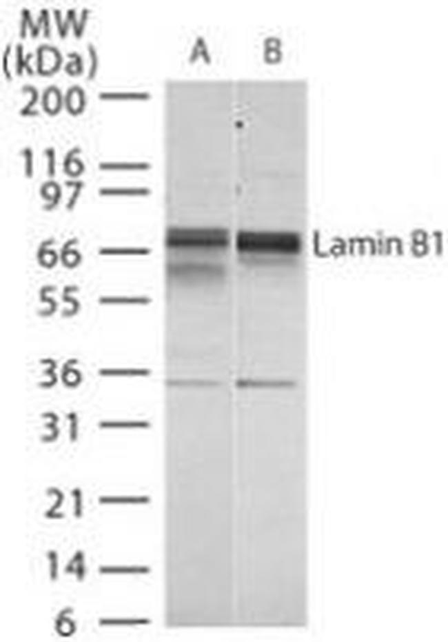 Lamin B1 Antibody in Western Blot (WB)