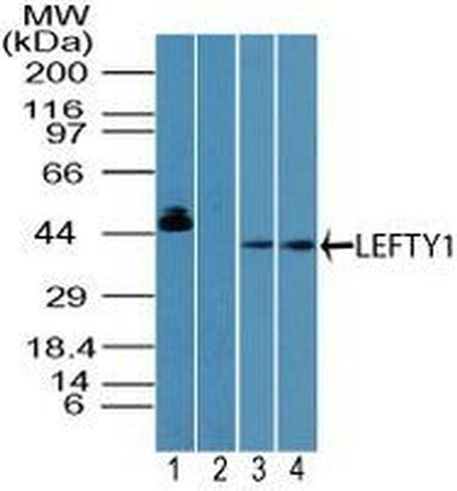 Lefty1/Lefty2 Antibody in Western Blot (WB)