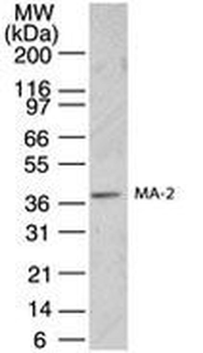 MA2 Antibody in Western Blot (WB)