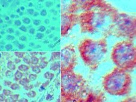 MEIS1 Antibody in Immunohistochemistry (Paraffin) (IHC (P))