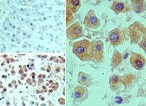 MEKK2 Antibody in Immunohistochemistry (Paraffin) (IHC (P))