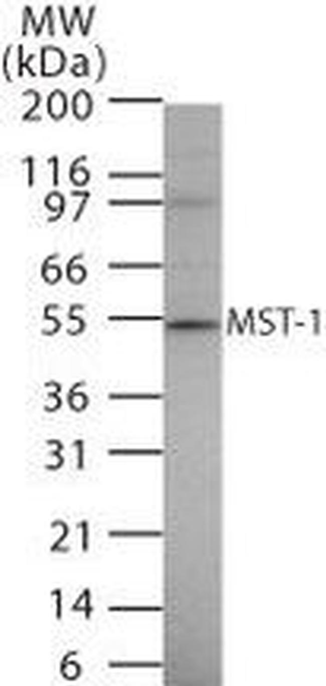 MSP Antibody in Western Blot (WB)