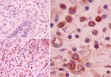 NALP2 Antibody in Immunohistochemistry (Paraffin) (IHC (P))