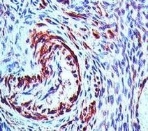NALP7 Antibody in Immunohistochemistry (Paraffin) (IHC (P))