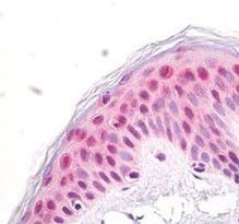 NUP35 Antibody in Immunohistochemistry (Paraffin) (IHC (P))