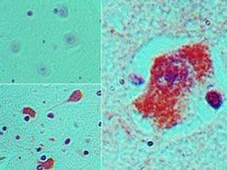 Nestin Antibody in Immunohistochemistry (Paraffin) (IHC (P))